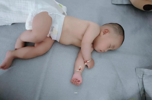 七台河宝宝脸上有白色斑块